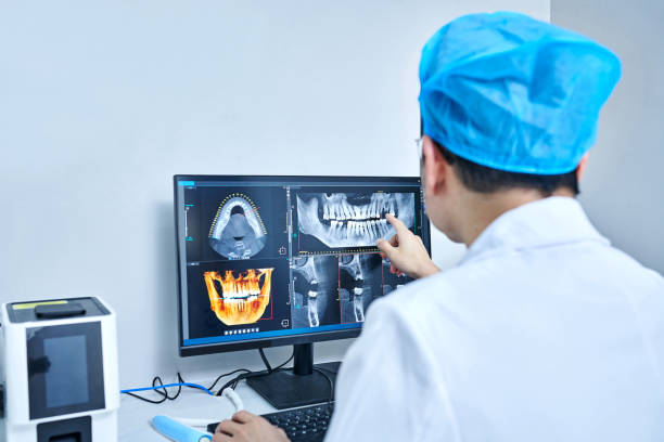 Best Knocked-Out Tooth (Avulsed Tooth) Treatment in Washington Mills, NY